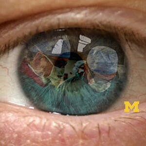 Kenyon Online Courses Introduction to Cataract Surgery for Kenyon College Students in Gambier, OH